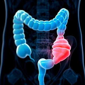 Causes of constipation and how to relieve it naturally